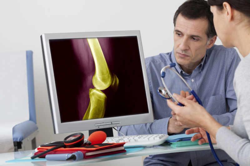 Artrosis de rodilla o gonartrosis