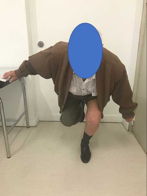 Paciente de 78 años intervenido prótesis de rodilla izquierda demostrando su satisfacción con la cirugía 